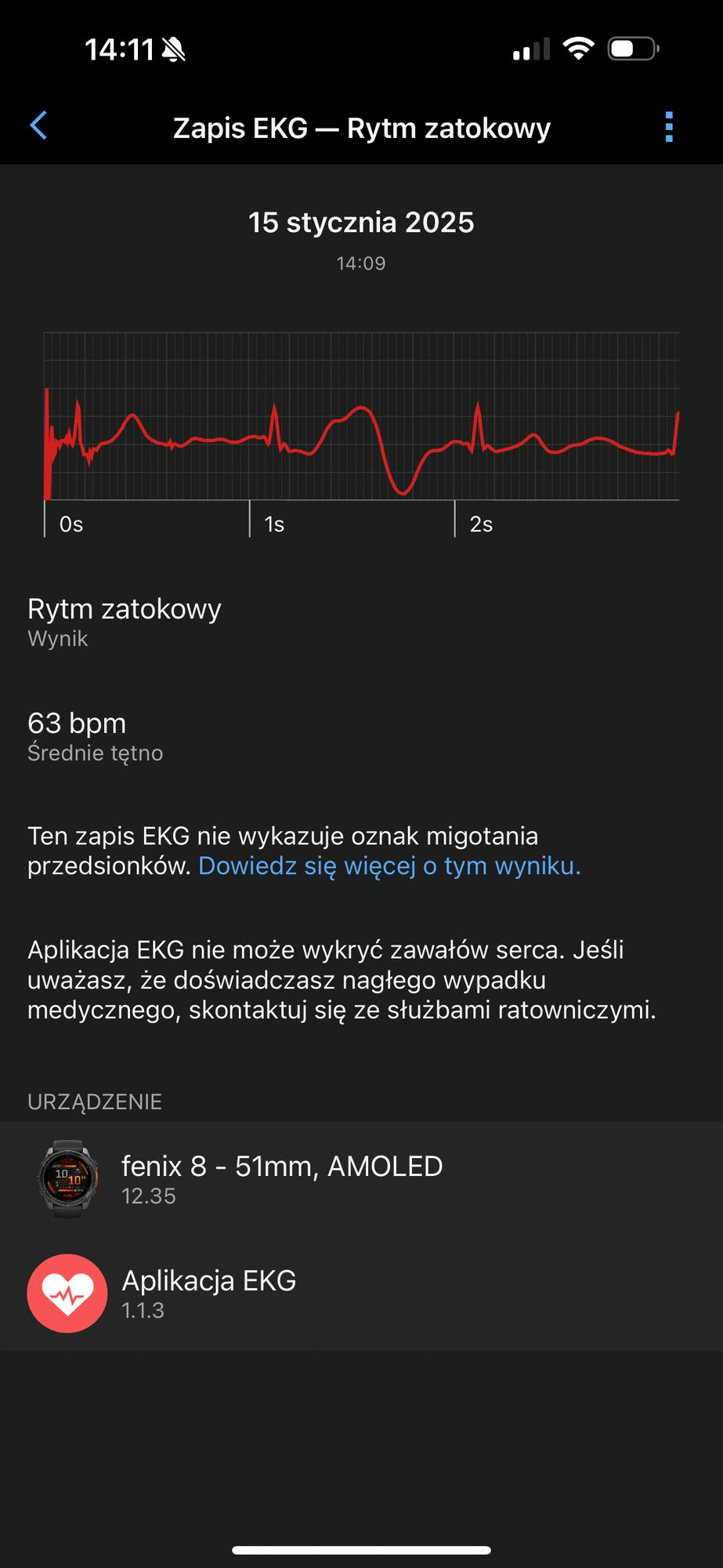 Wyświetlanie wyników EKG i analiz w aplikacji Garmin Connect